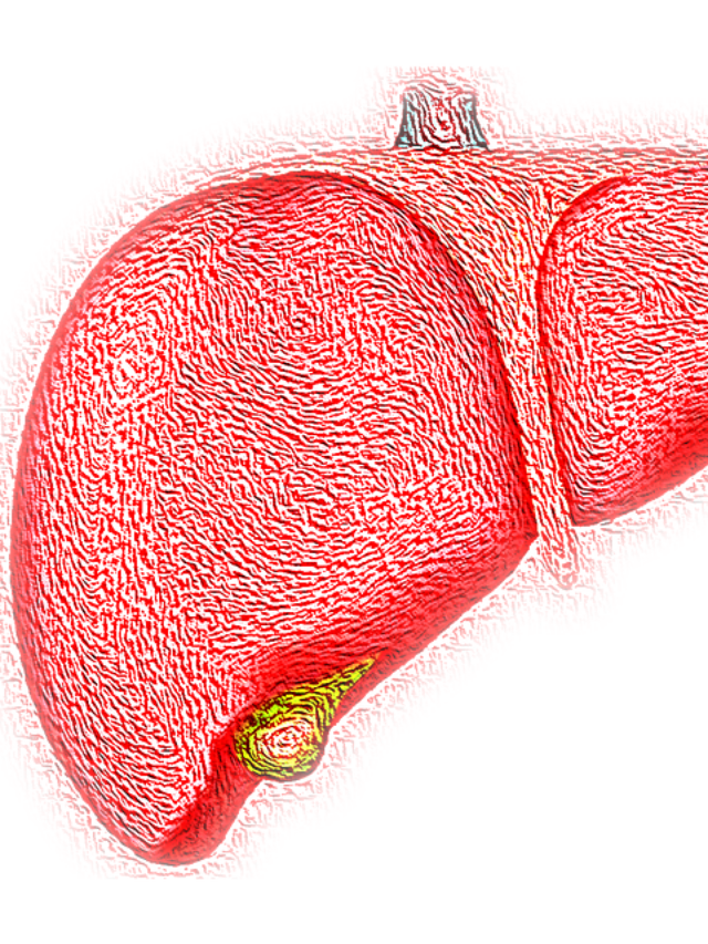 10 Critical Warning Signs of Fatty Liver: Unveiling the Hidden Dangers